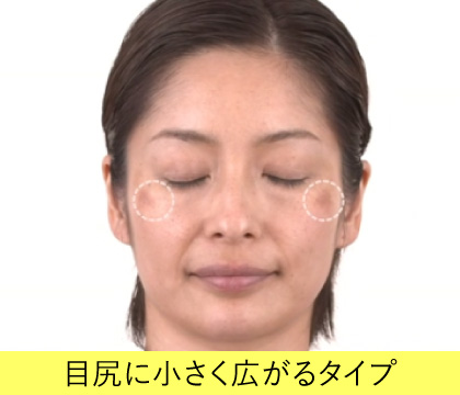 目尻に小さく広がるタイプの説明画像